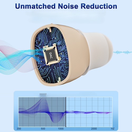 Amplificatore audio